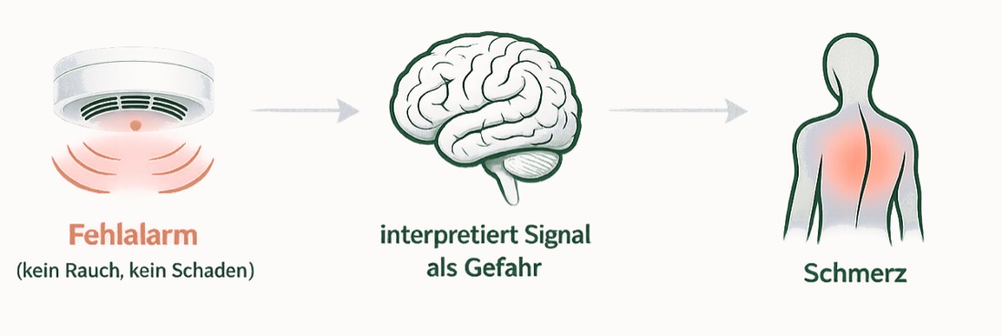 Grafik: Fehlalarm wie bei einem Rauchmelder – kein Rauch, kein Schaden, doch das Gehirn interpretiert das Signal als Gefahr, und es entsteht Schmerz